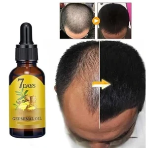 7 day ginger hair growth oil 40ml | زيت الزنجبيل لنمو الشعر — natural hair regrowth serum | توصيل سريع 🇸🇦